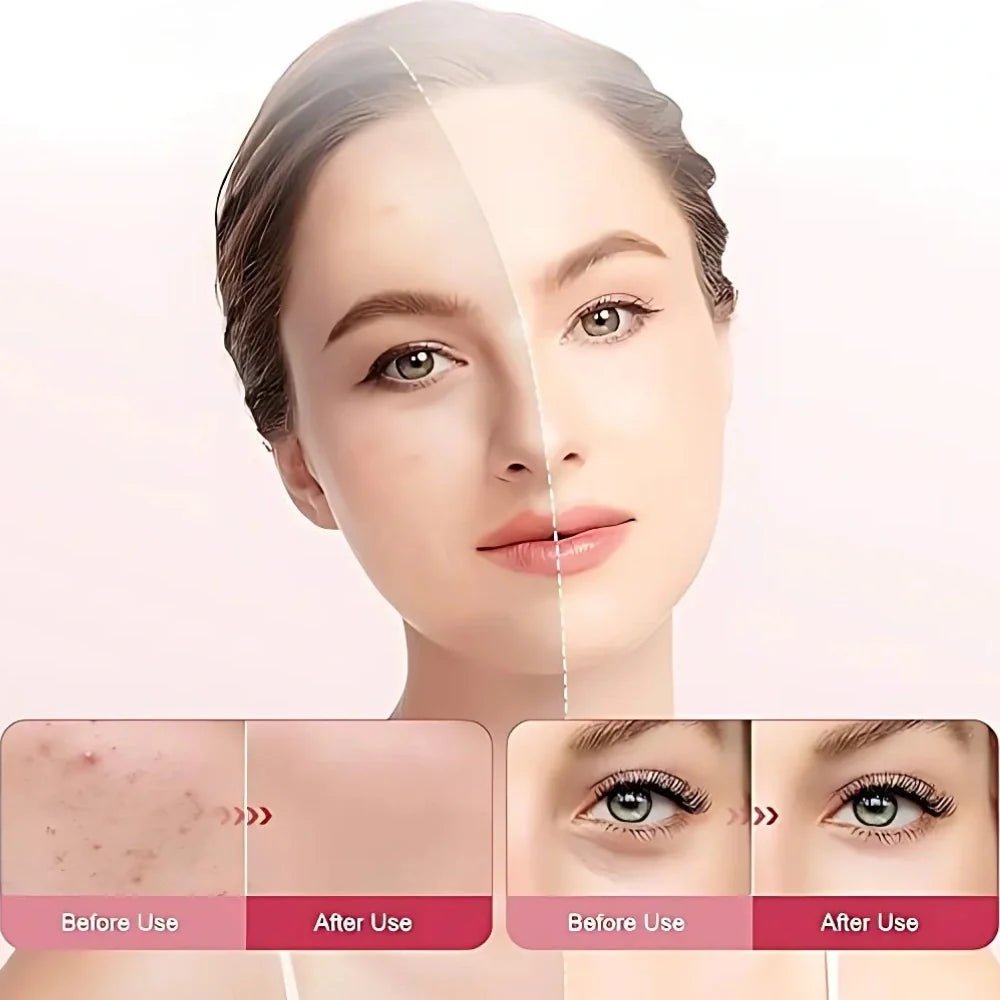 LumaDerm™ Red Light Therapy Panel - Luminoya